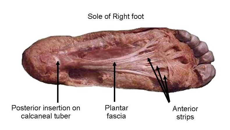 Anterior sales calcaneal spur